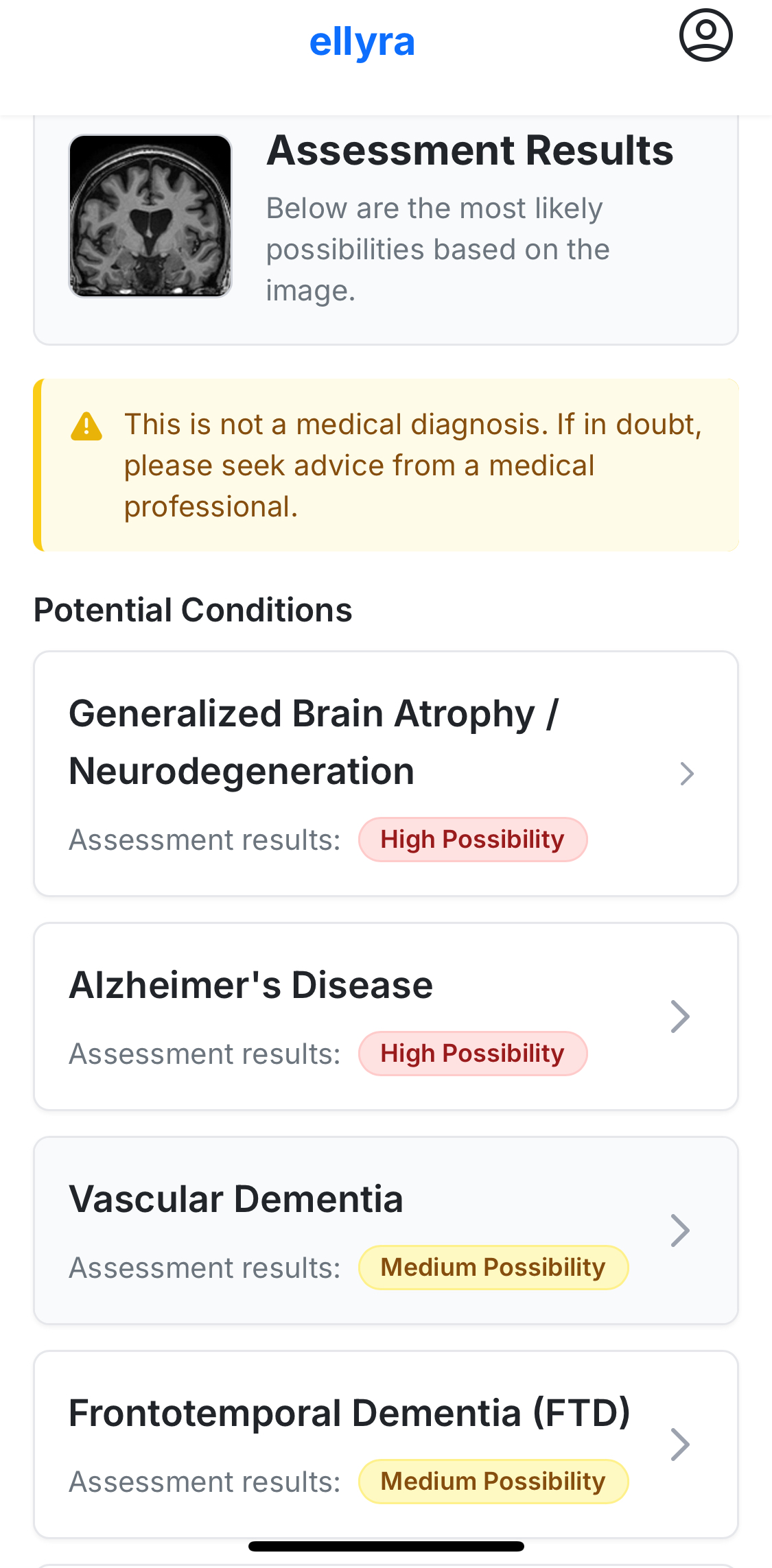 Ellyra Assessment Results showing brain scan analysis